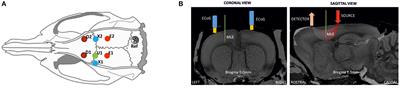 What Triggers the Interictal Epileptic Spike? A Multimodal Multiscale Analysis of the Dynamic of Synaptic and Non-synaptic Neuronal and Vascular Compartments Using Electrical and Optical Measurements